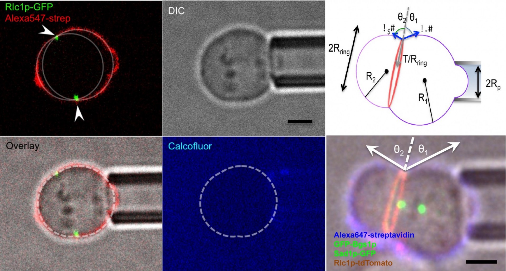 In the method micropipette aspiration measures membrane tension, and the furrow angles are measured optically. A force balance yields the ring tension.