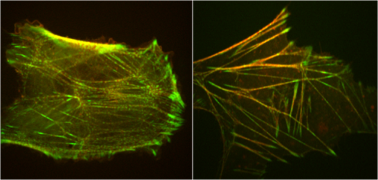 Labelled stress fibers in animal cells, showing striated patterning characteristic of sarcomeric actomyosin organization. Images courtesy of Mary Beckerle lab, University of Utah. 