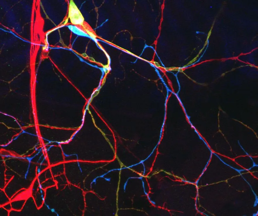 Fake color neuron cells I guess??? G