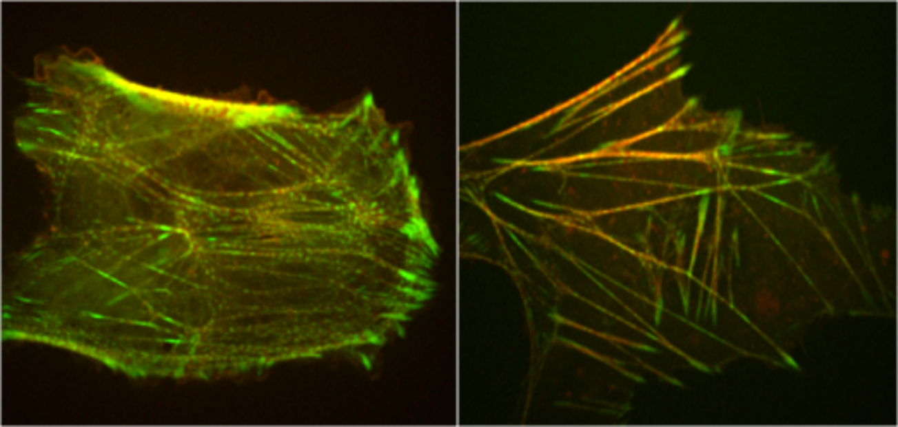 Labelled stress fibers in animal cells, showing striated patterning characteristic of sarcomeric actomyosin organization. Images courtesy of Mary Beckerle lab, University of Utah.